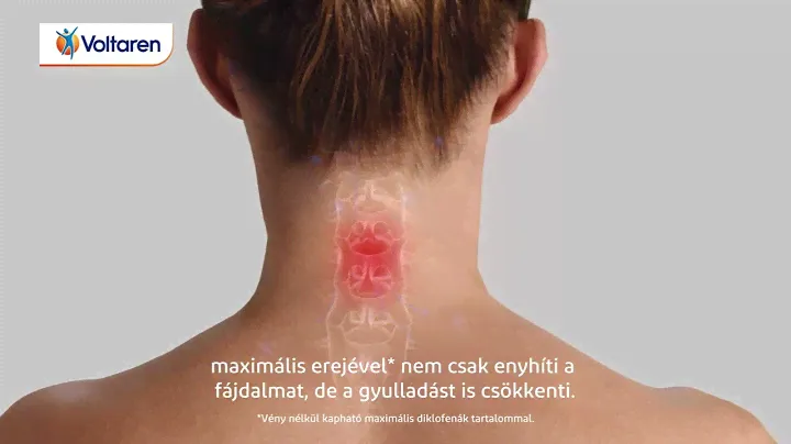 Voltaren lágy kapszula formában!