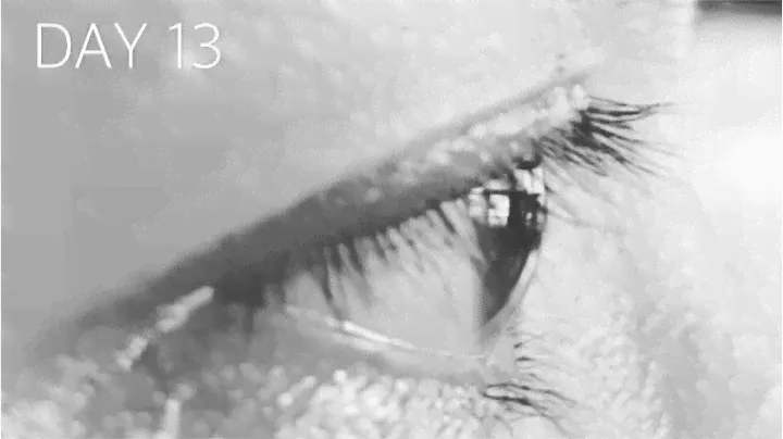 WENDISTER® Rapid Eyelash Growth Serum - SEE REAL RESULTS!